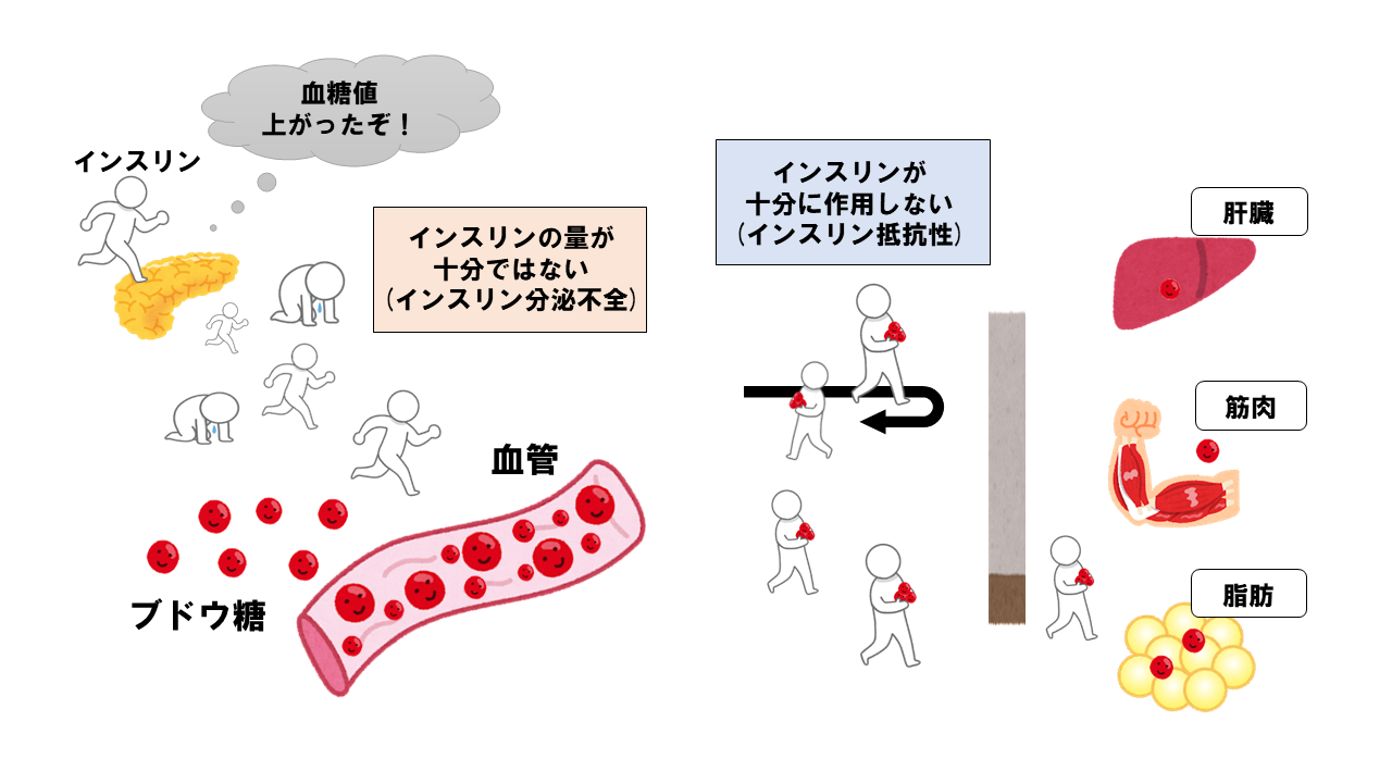 糖尿病の初期症状をチェックしよう ～この症状って糖尿病？？～ | 赤羽もりクリニック